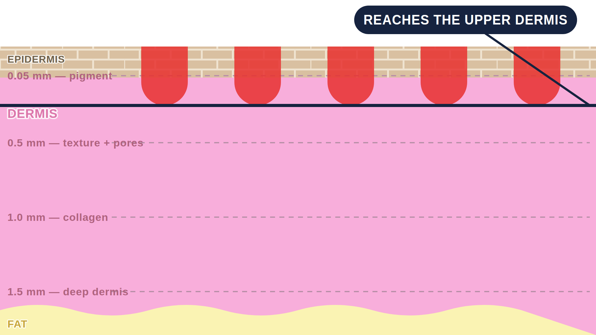 Diagram: how Clear + Brilliant works in the skin