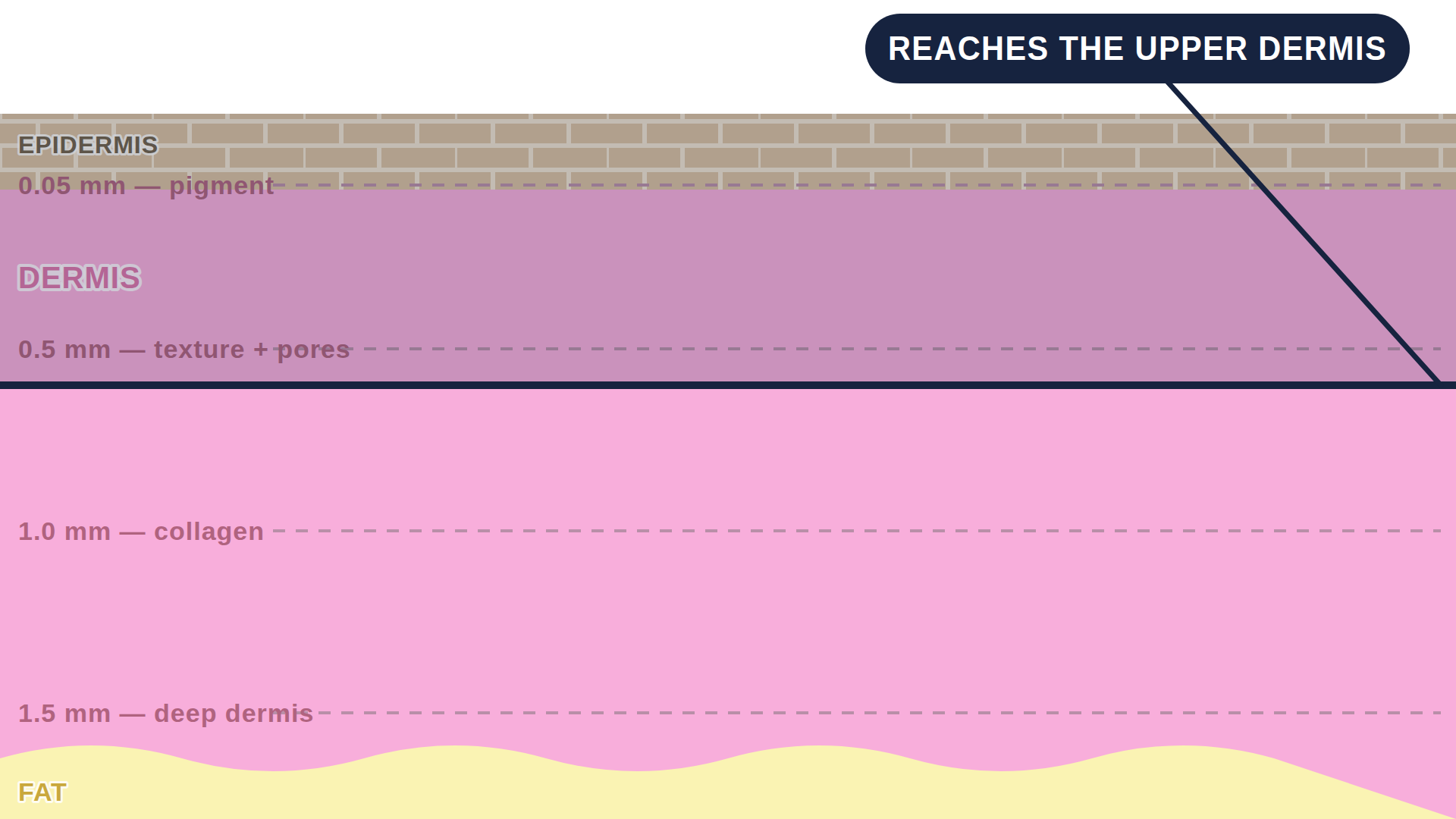 Diagram: how Shave Removal works in the skin