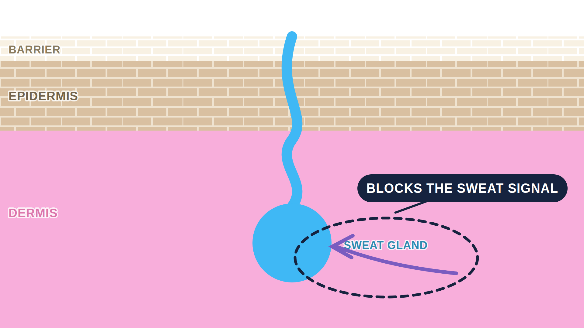 Diagram: how Qbrexza works in the skin