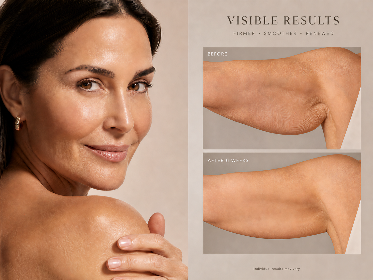 VORYS Collagen Oil clinical skincare results
