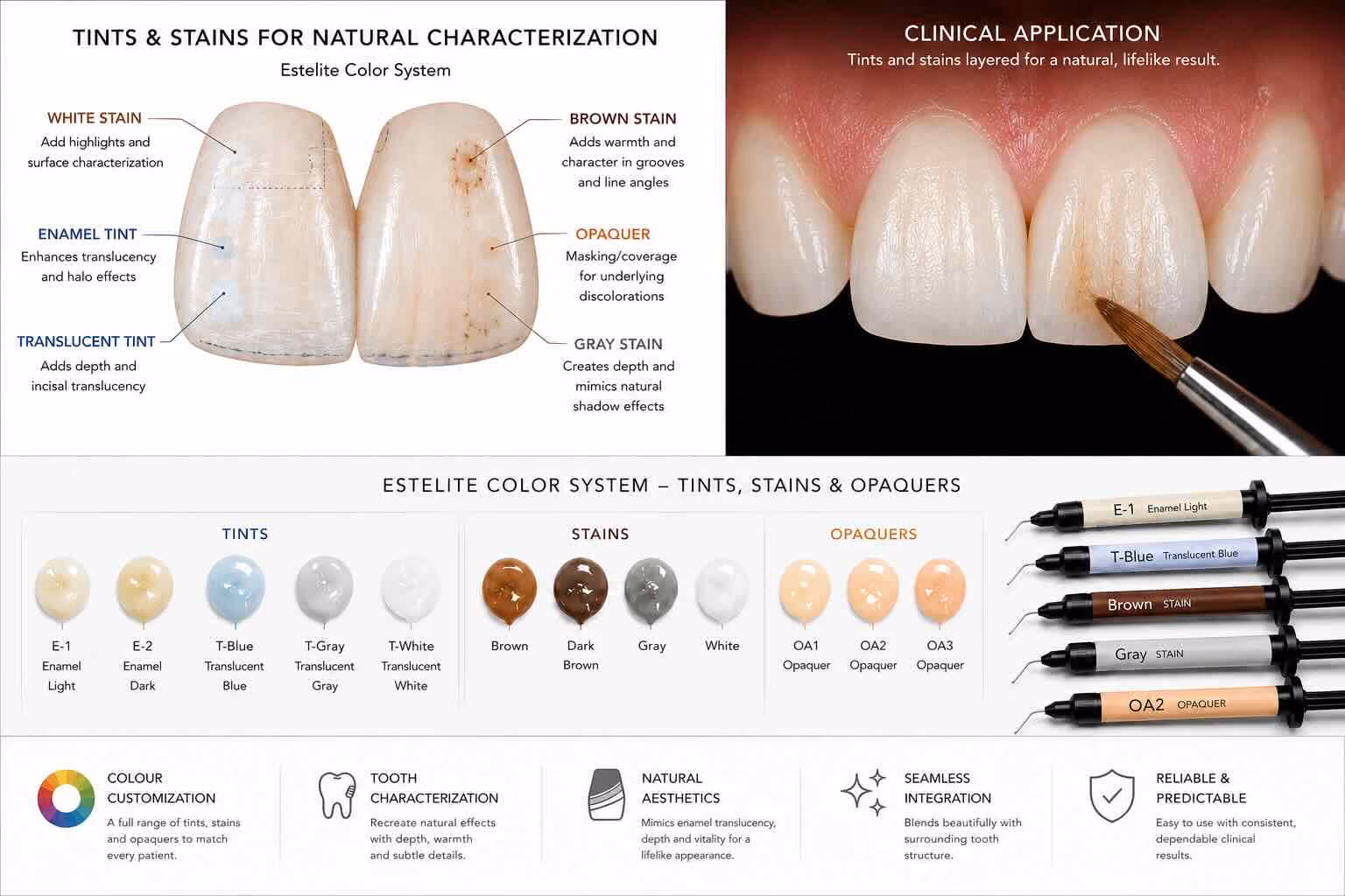 Composite tints and stains used to characterize bonded front teeth