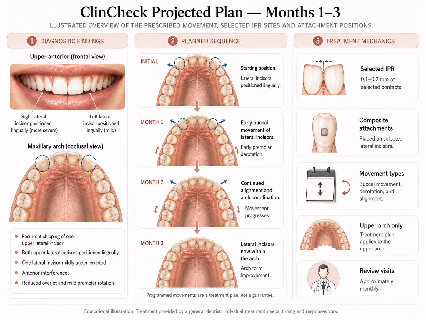 Diagram of the diagnostic findings, problem list and projected month-by-month clear aligner plan.
