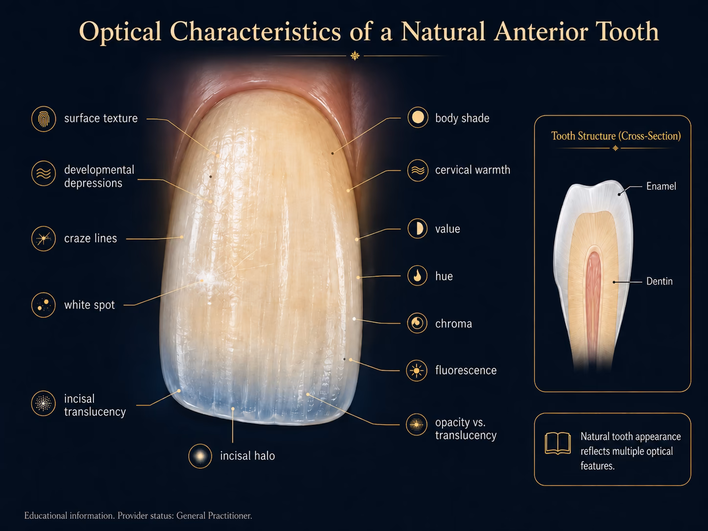 Labelled diagram of a natural anterior tooth showing translucency, surface texture, craze lines, white spots and cervical warmth.