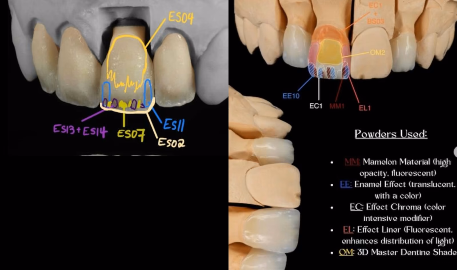 Annotated dental shade map prescription showing porcelain powder placement across the tooth.