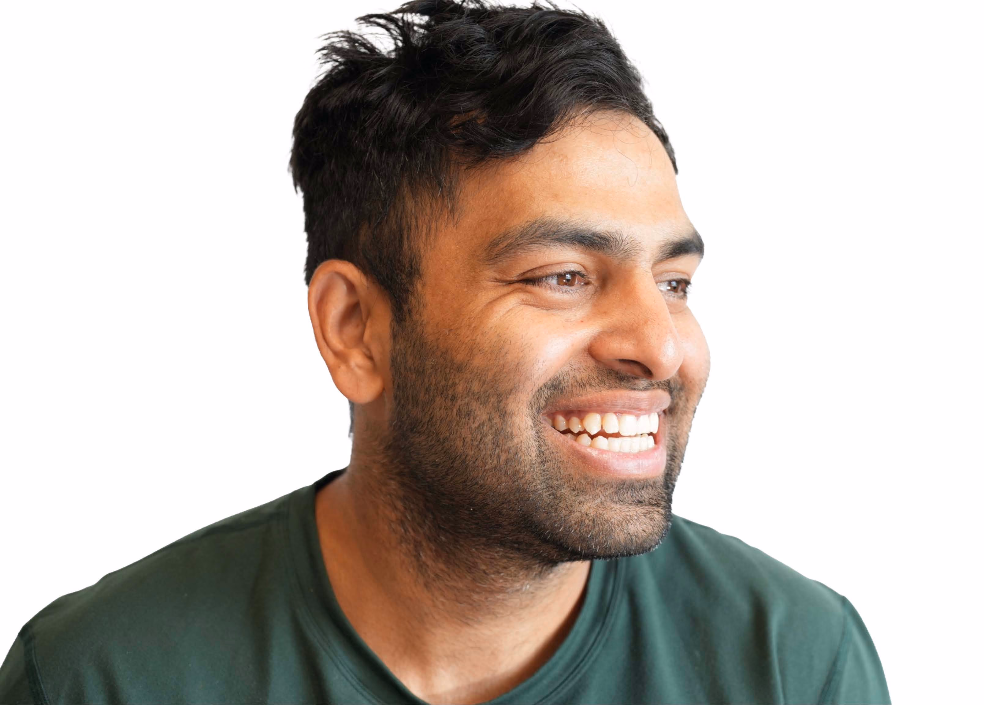 Patient's smile before composite bonding to close a gap between the front teeth