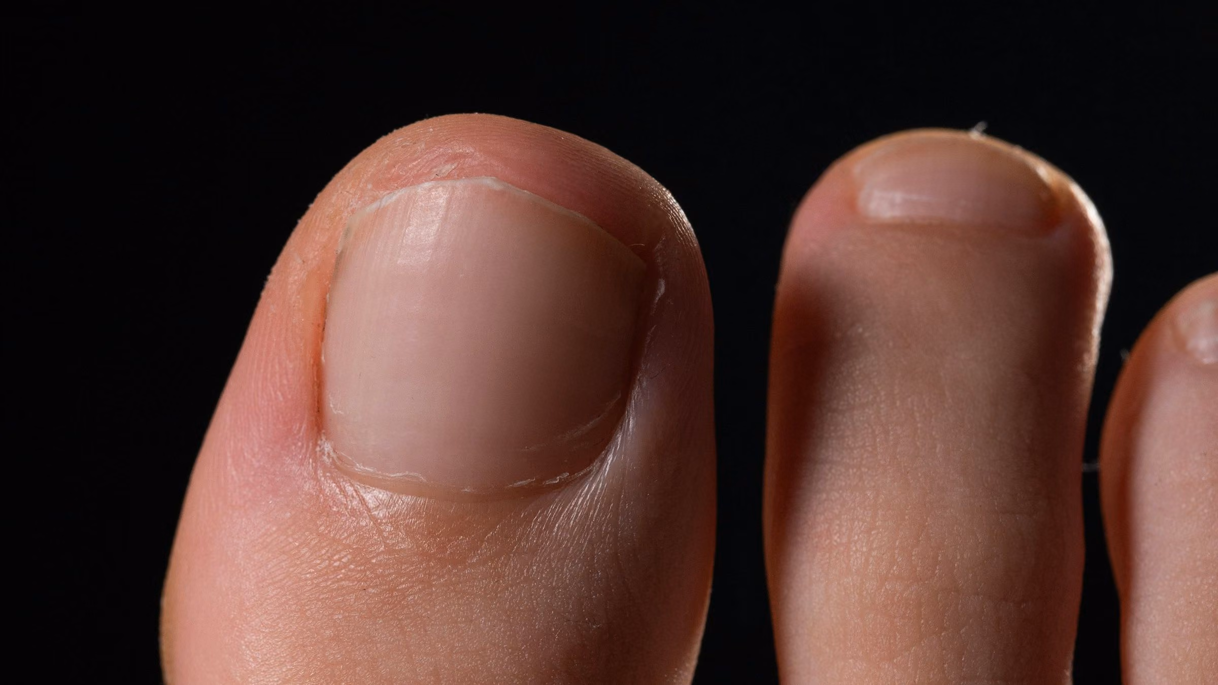 A close-up of toes against a dark background
