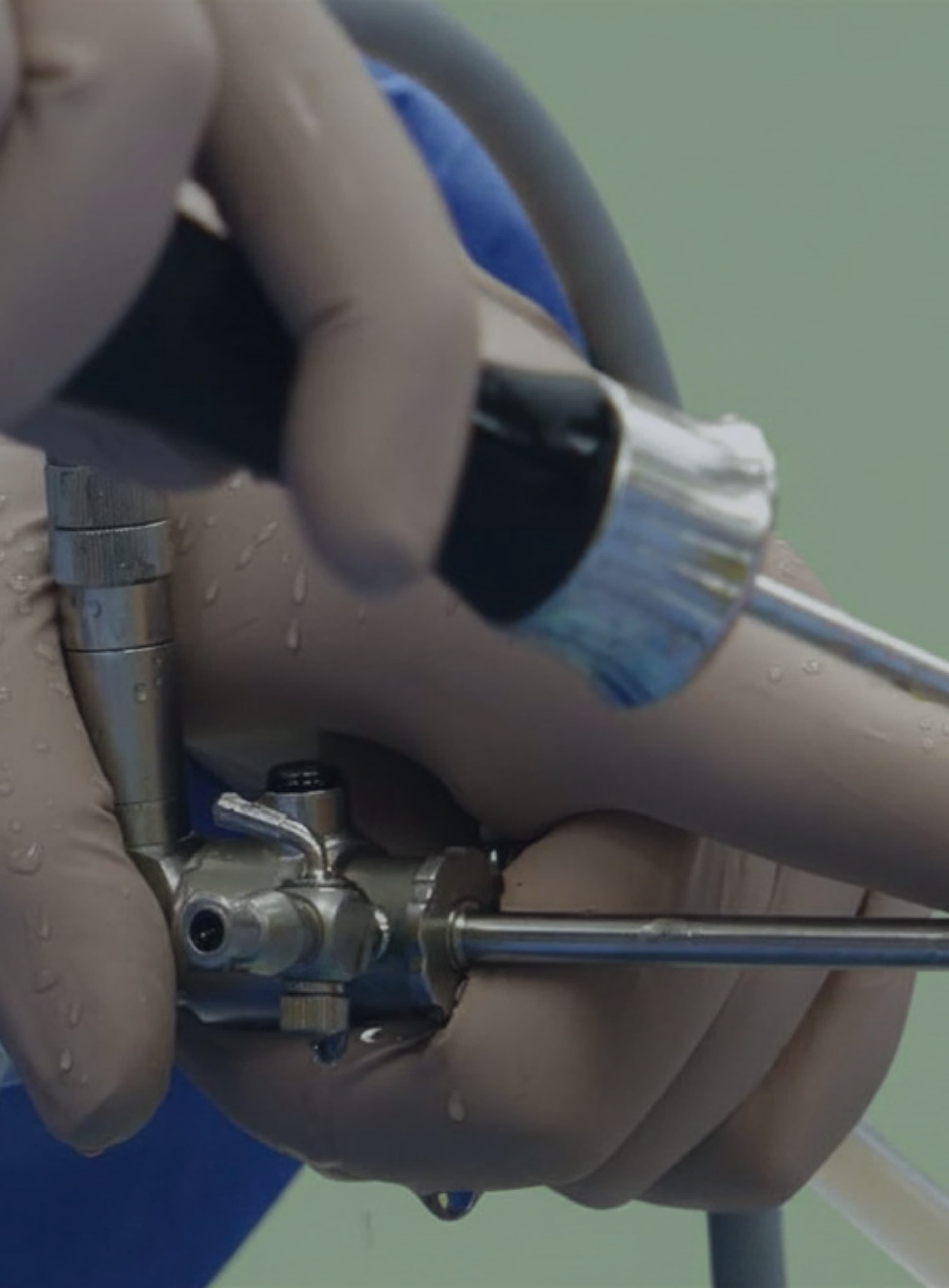 a close up image of surgeons hands holding knee arthroscopy equipment. the handles and probes are visible only.