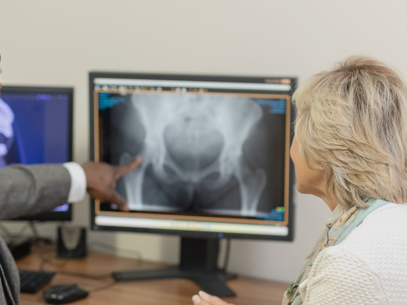 a close up image of a hip x-ray on a computer screen.