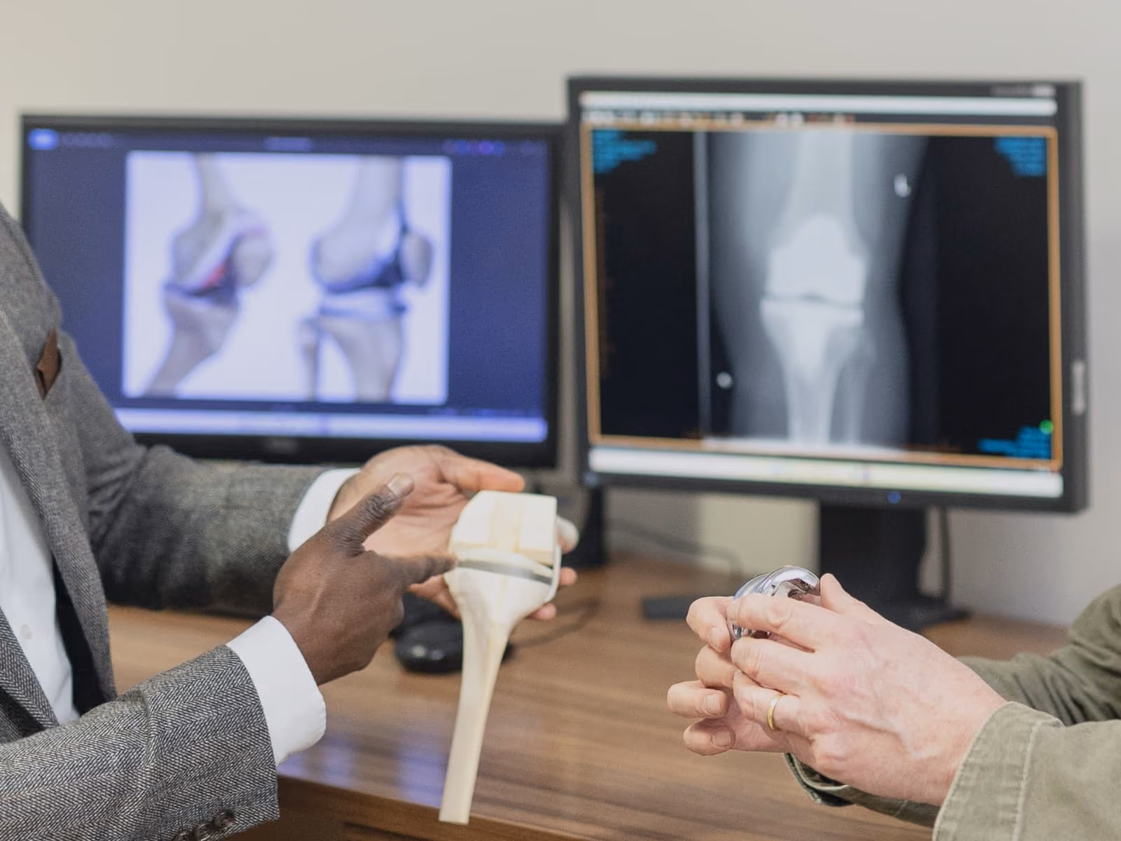 A close up image of Mr Oni and a Male patients hands both holding models of knee joints, held in front of clear x-ray and scan images on his computer screens.