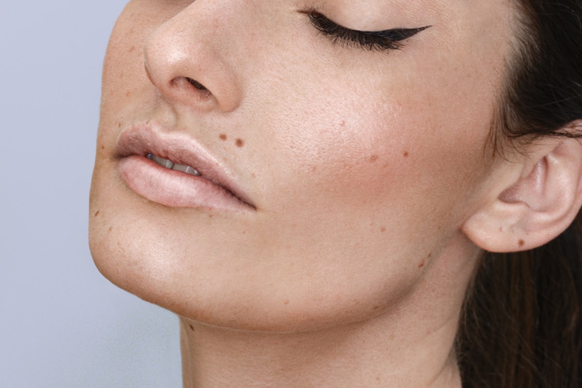 Close-up of skin with freckles and pigmentation