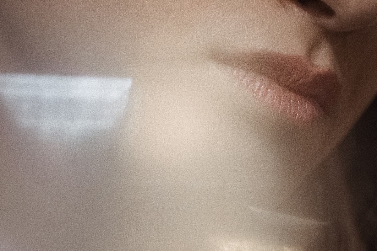 Can You Get Rid of Melasma for Good? An Honest Answer