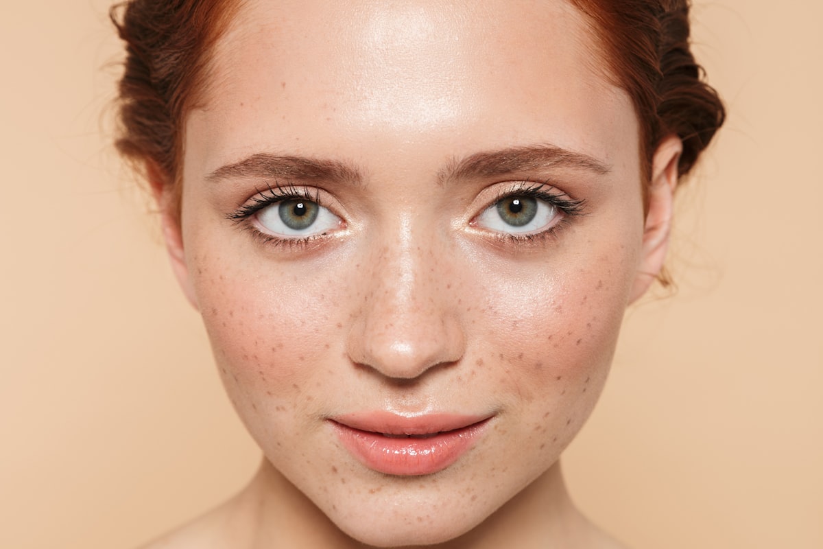 Melasma vs Sun Spots vs PIH: How to Tell Them Apart