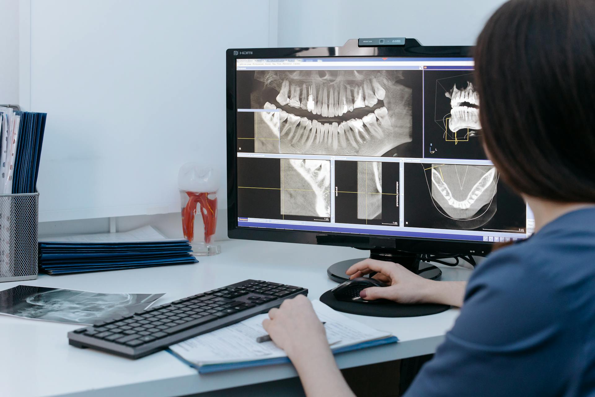 A person studies dental X-rays on a computer monitor at a desk.