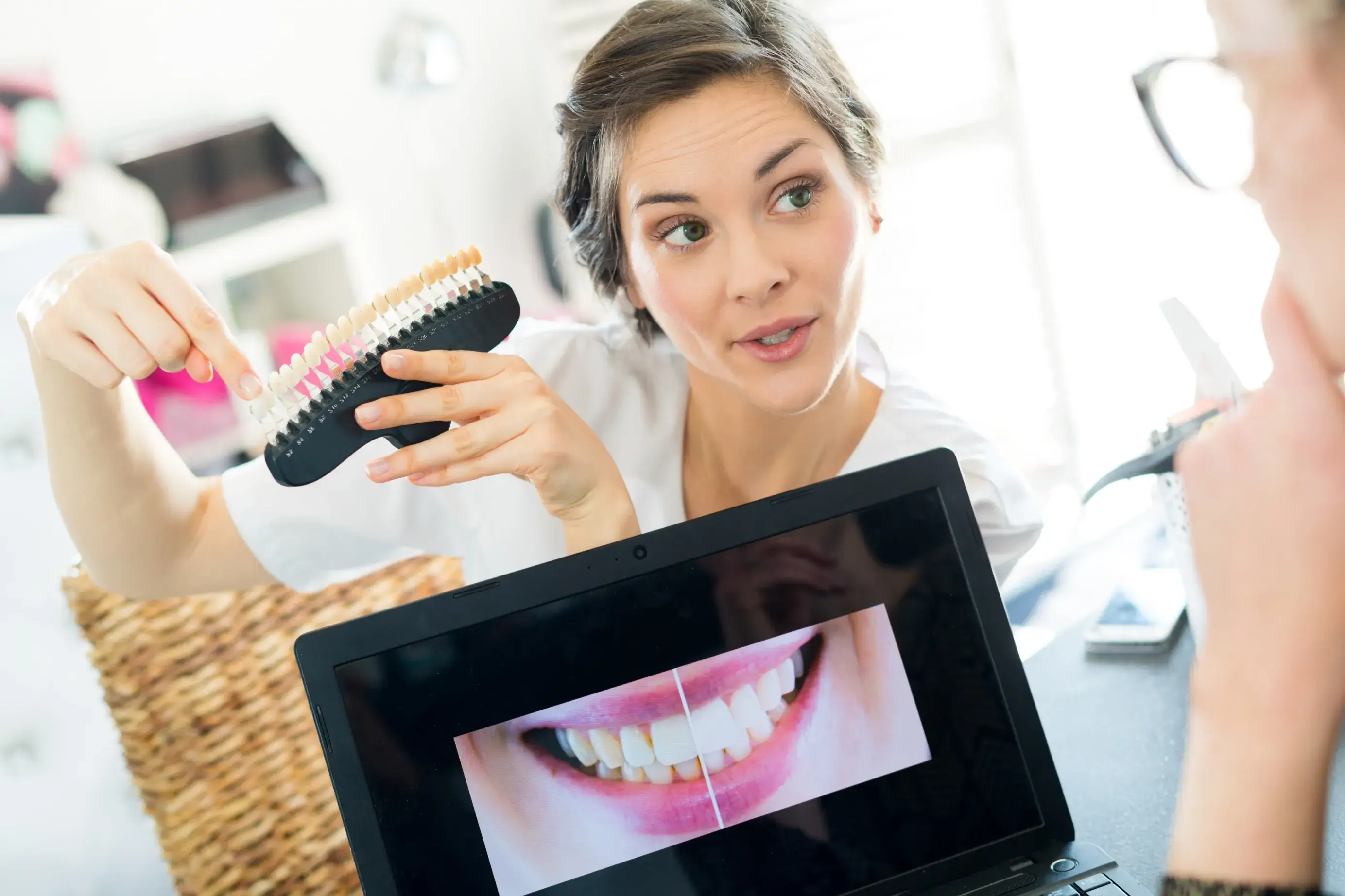 A woman shows a dental color chart, pointing to a laptop displaying a teeth whitening example.