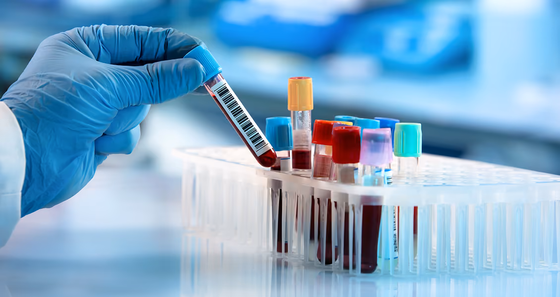 Functional laboratory testing at Body Blu
