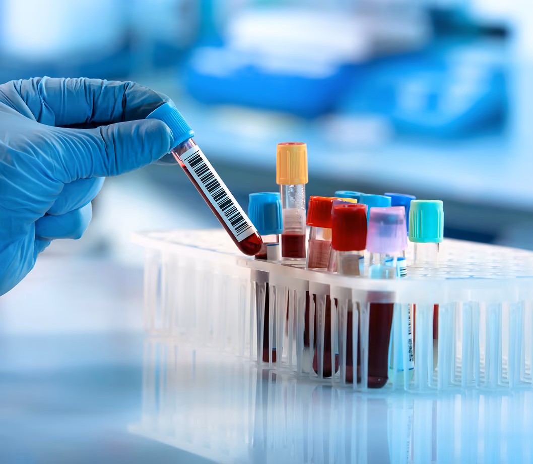 Functional laboratory testing at Body Blu in Cardiff, CA