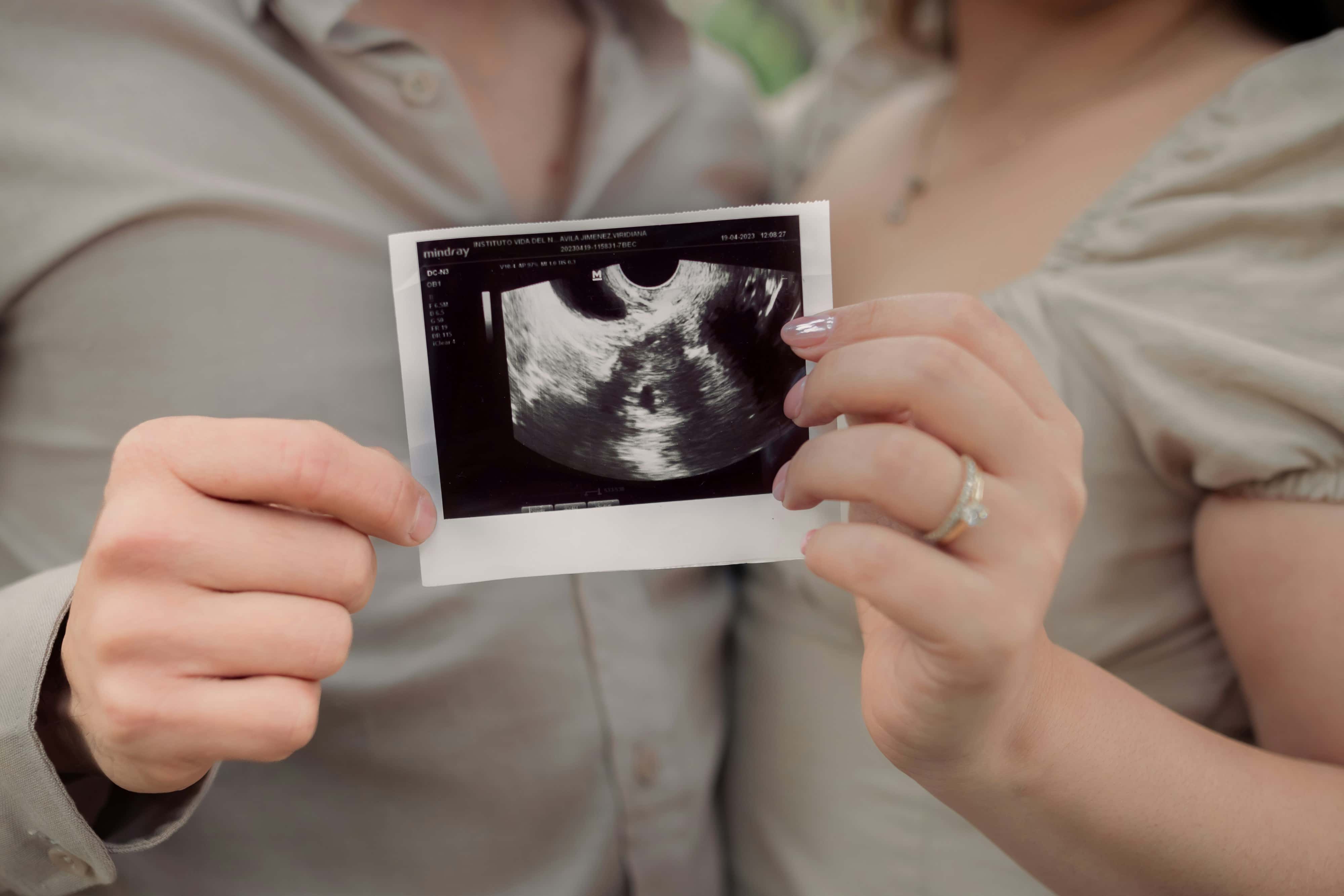 Close-up of two people's hands holding an ultrasound photo, one wearing an engagement ring.