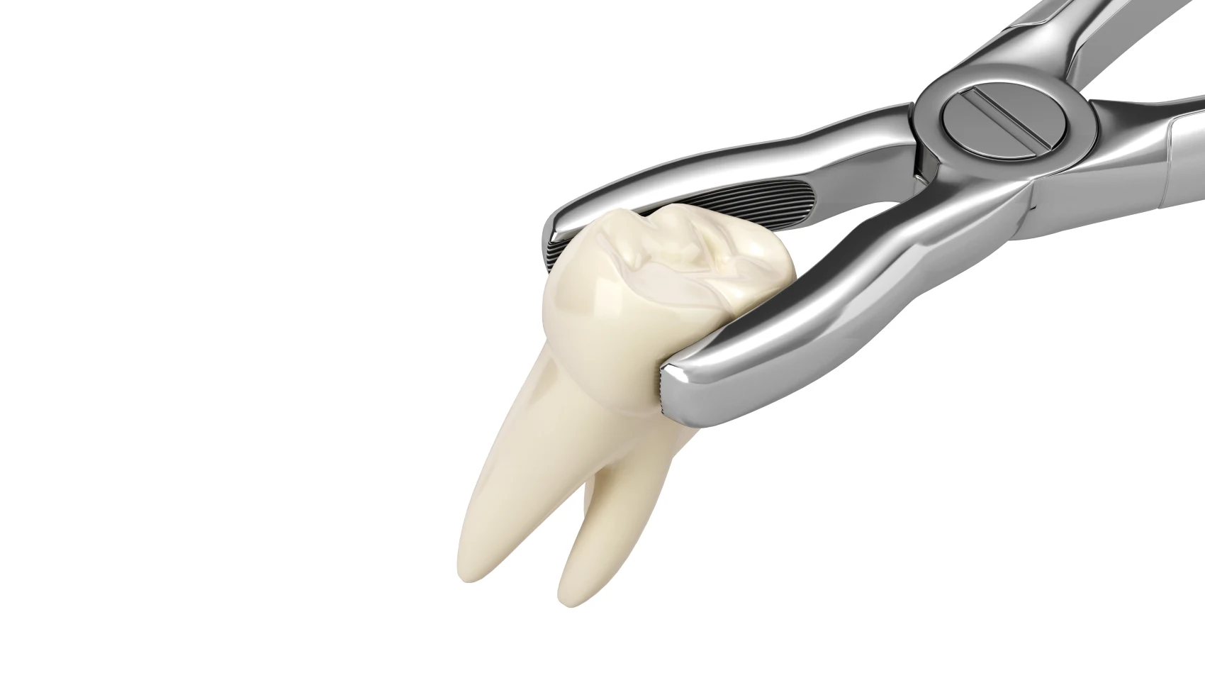 Tooth Extractions in Branson, Nixa & Springfield, MO