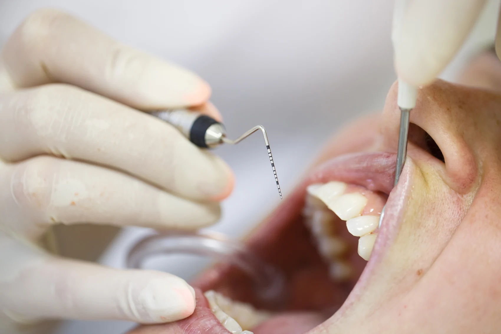 Branson, Nixa & Springfield, MO Periodontal Care
