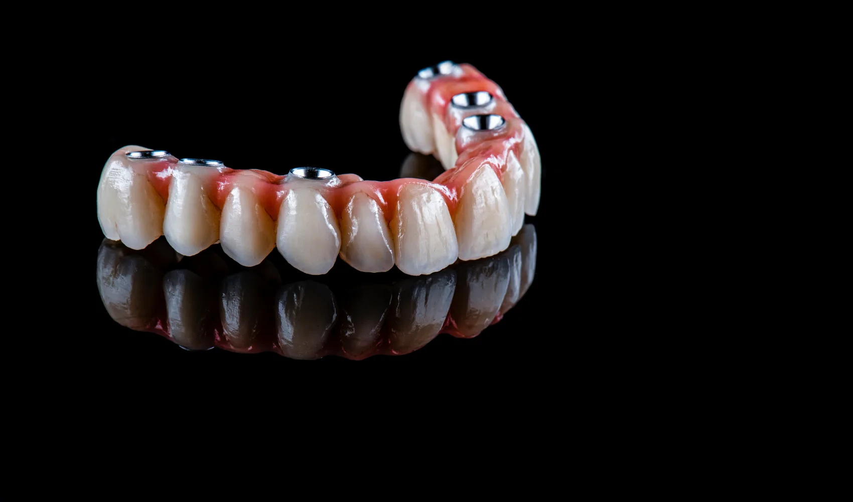 Full Arch Implants Branson, Nixa & Springfield, MO