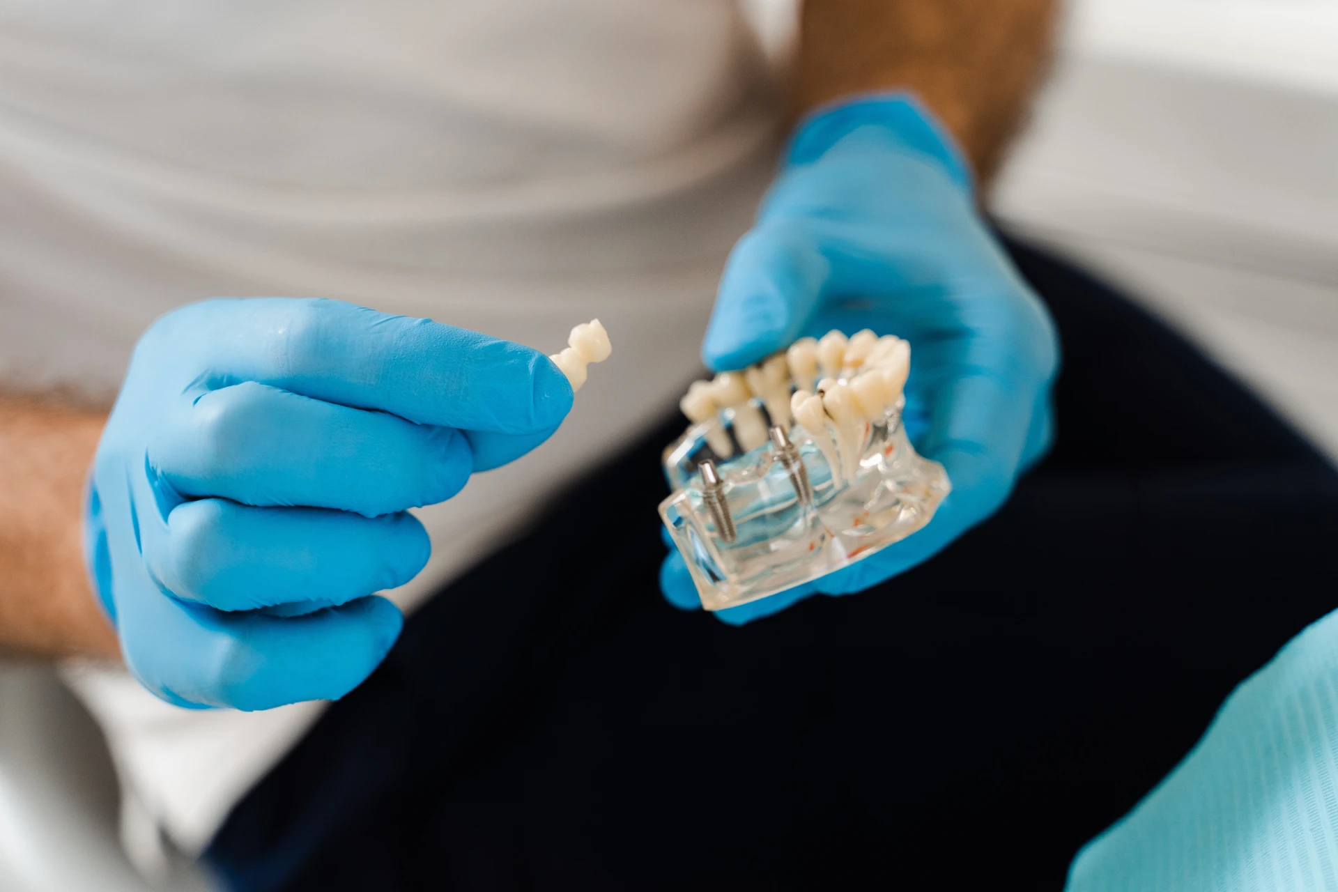 Dental Implants in Branson, Nixa & Springfield, MO