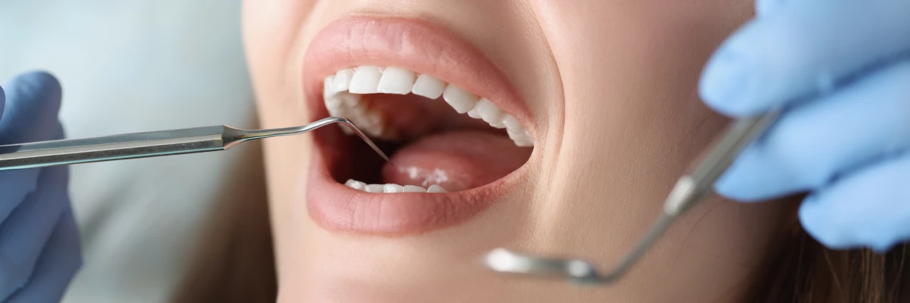 Branson, Nixa & Springfield, MO Smile Test Drive