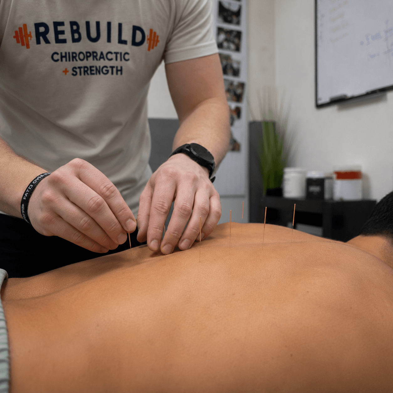 Precise needling that reaches restricted muscle directly, paired with movement so the release lasts.