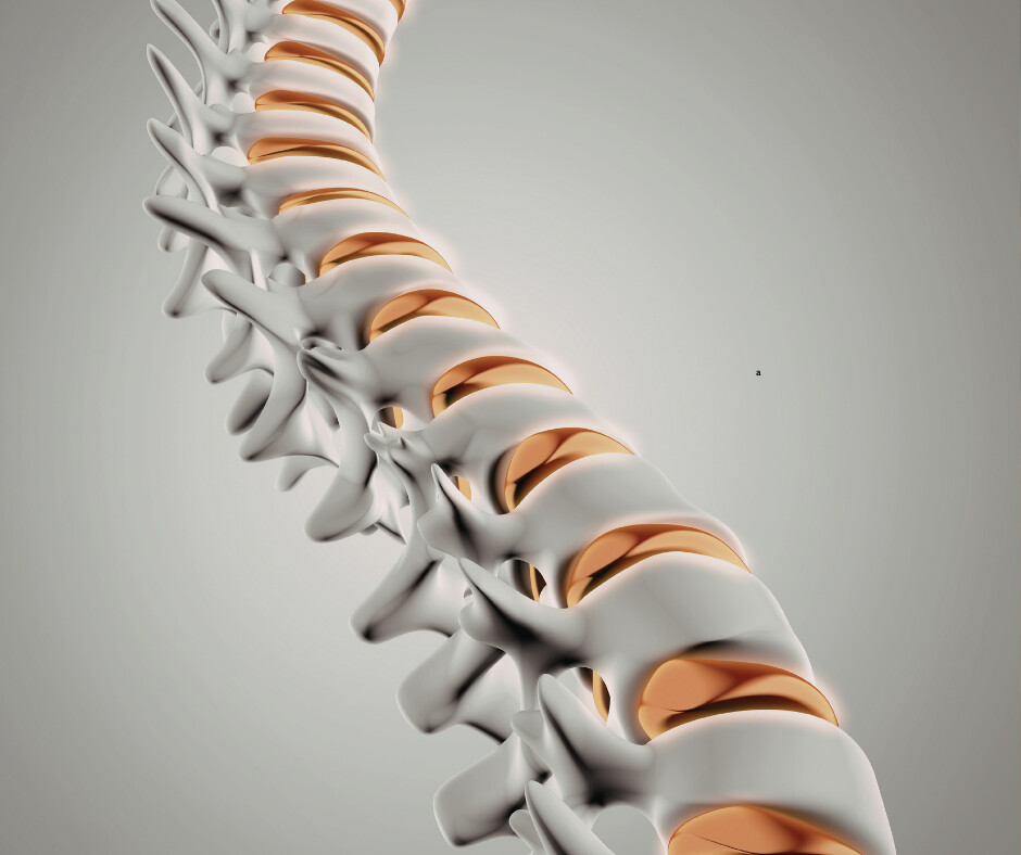 What 'Degenerative Disc Disease' Actually Means (And Why the Way You Heard It Is Keeping You Stuck)