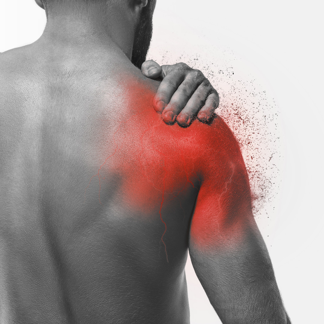 All Things Shoulder Pain