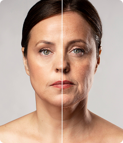 Before and after split portrait showcasing anti-aging stem cell therapy results for skin elasticity and wrinkle reduction.