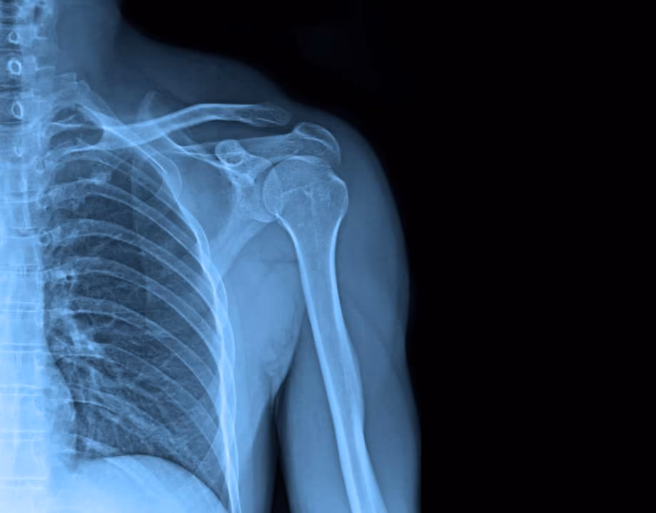 X-ray screening for success!
