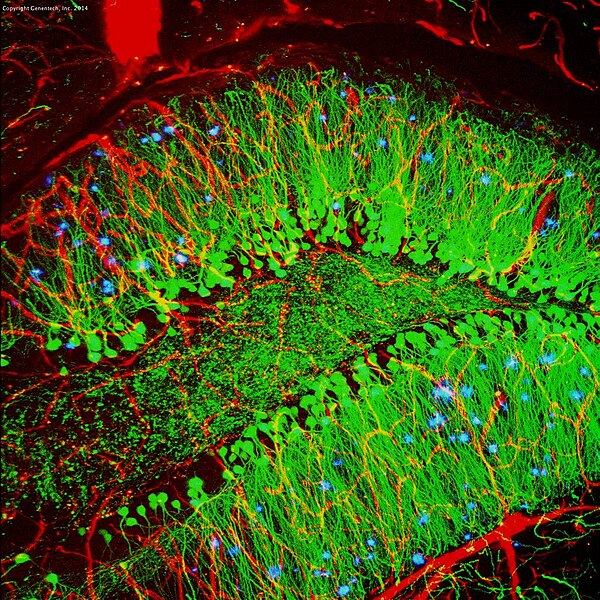 Advanced Imaging and Biomarker Implementation