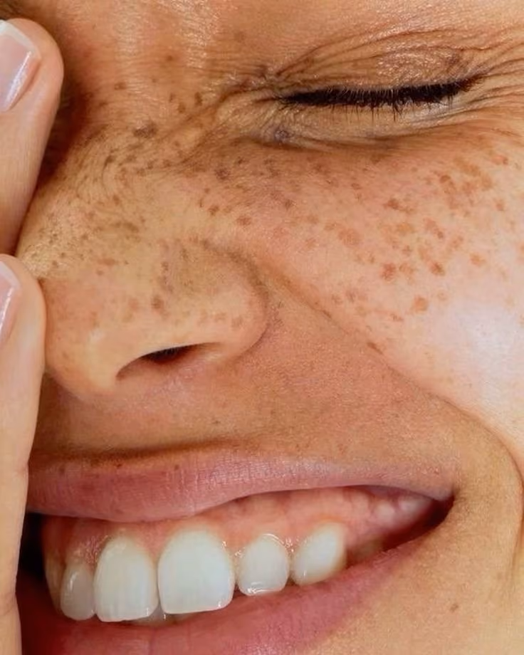 Close-up of a freckled face smiling with eyes closed and hand touching the cheek.