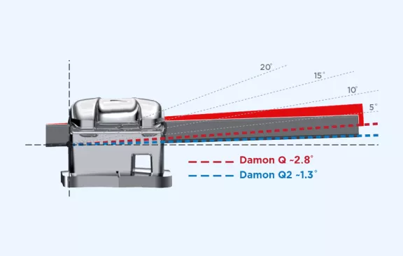 Diagram comparing the slot angle of Damon Q and Damon Q2 braces brackets