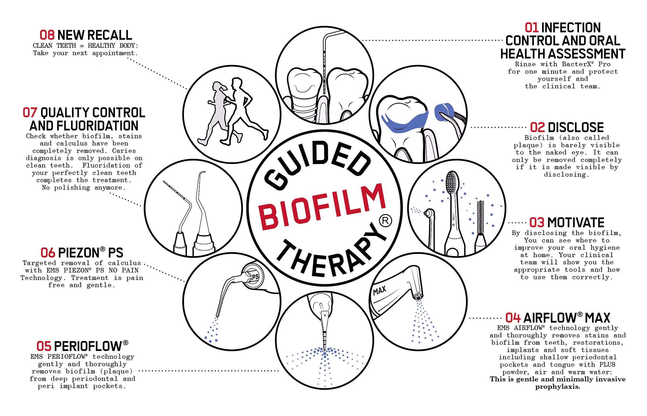 Guided Biofilm Therapy diagram showing the eight steps of the treatment