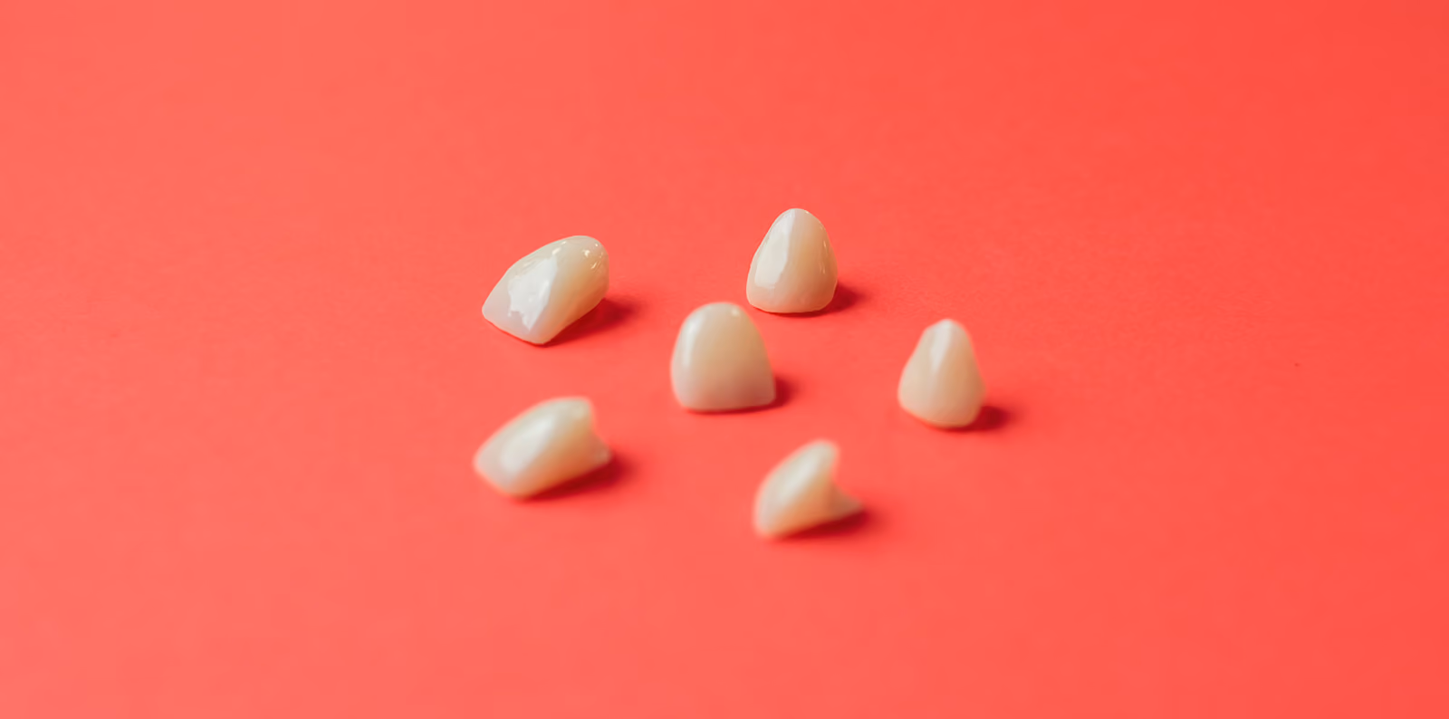 Custom dental veneers