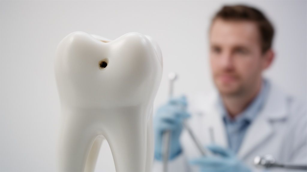 A close-up of a white tooth model with a cavity next to a blurred dentist in background.