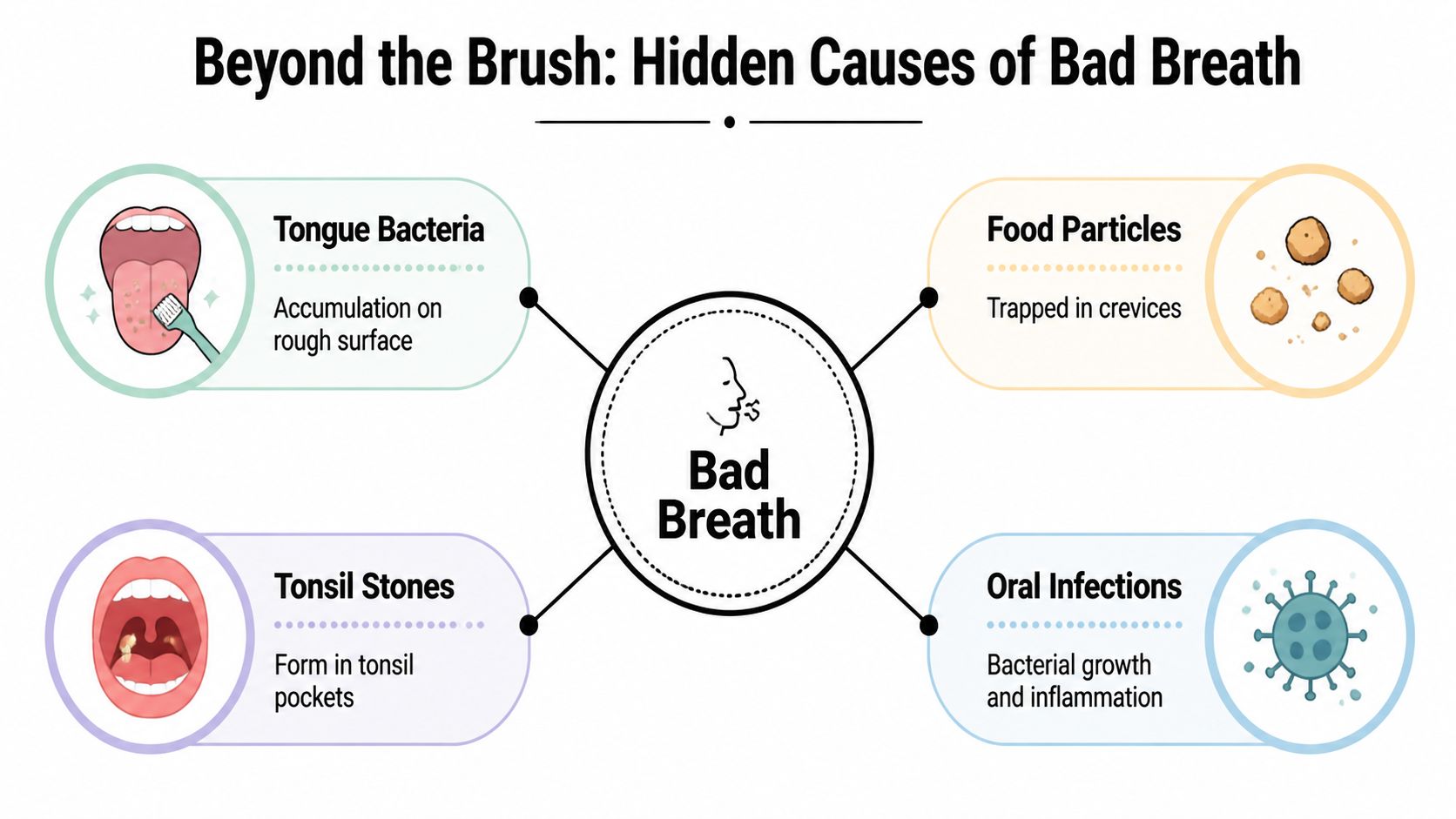 An infographic detailing the hidden causes of bad breath, including tongue bacteria, food particles, tonsil stones, and infections.