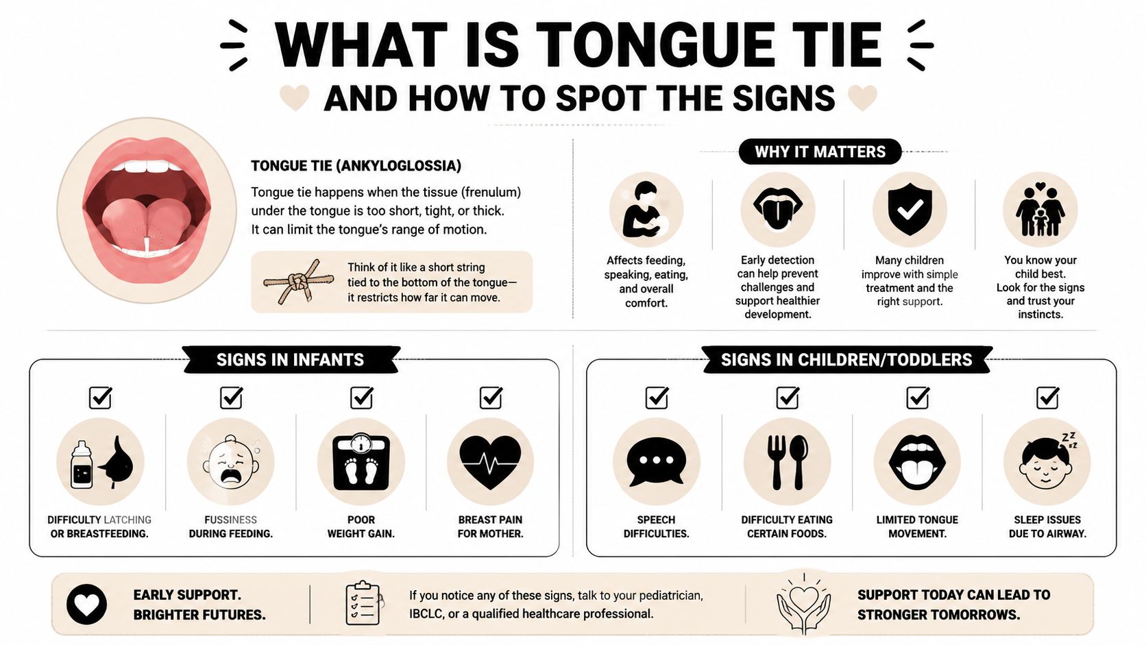 An educational infographic explaining the signs and impacts of tongue tie in infants and toddlers.