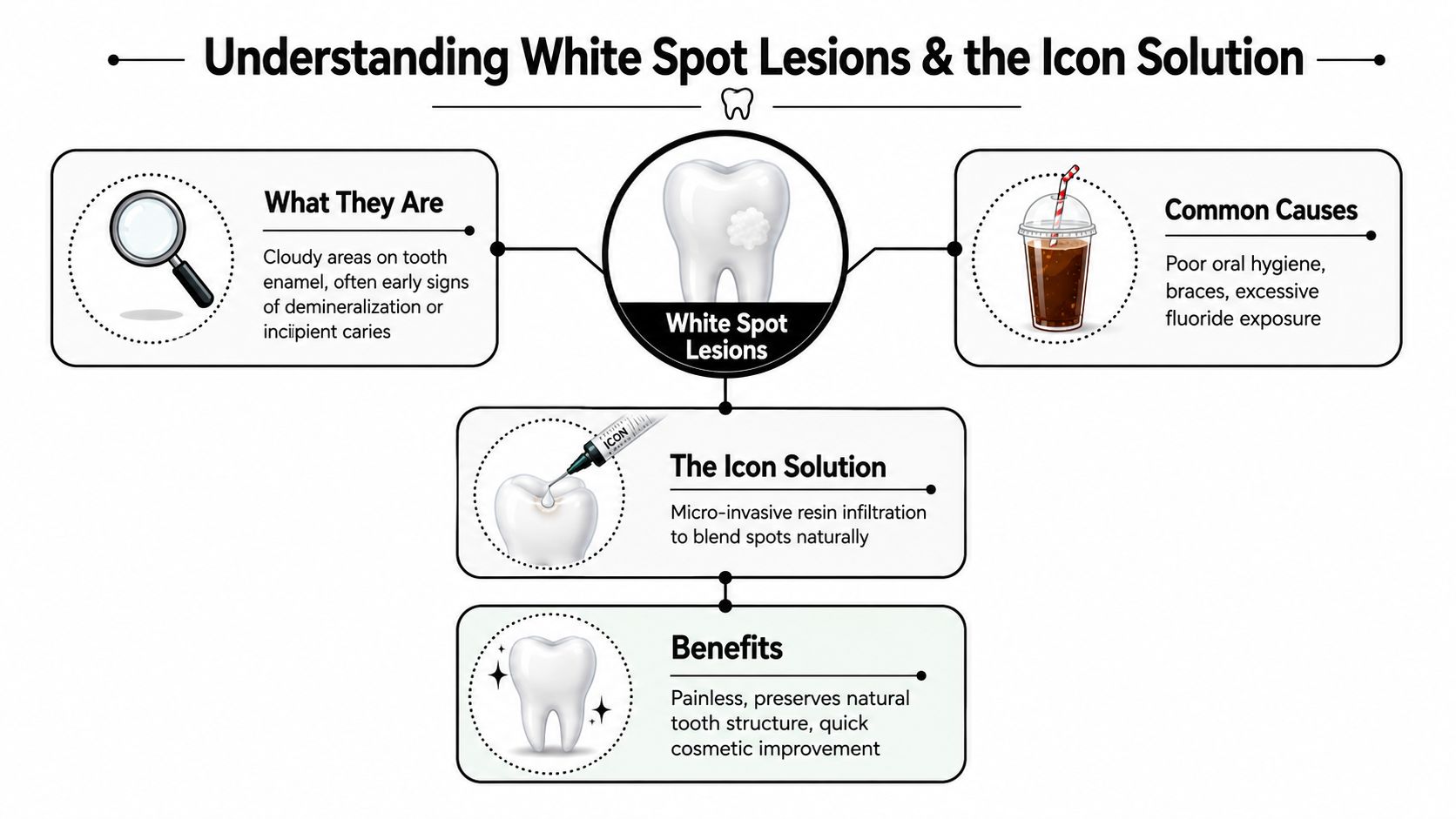 An infographic explaining white spot lesions on teeth and the benefits of Icon resin infiltration treatment.