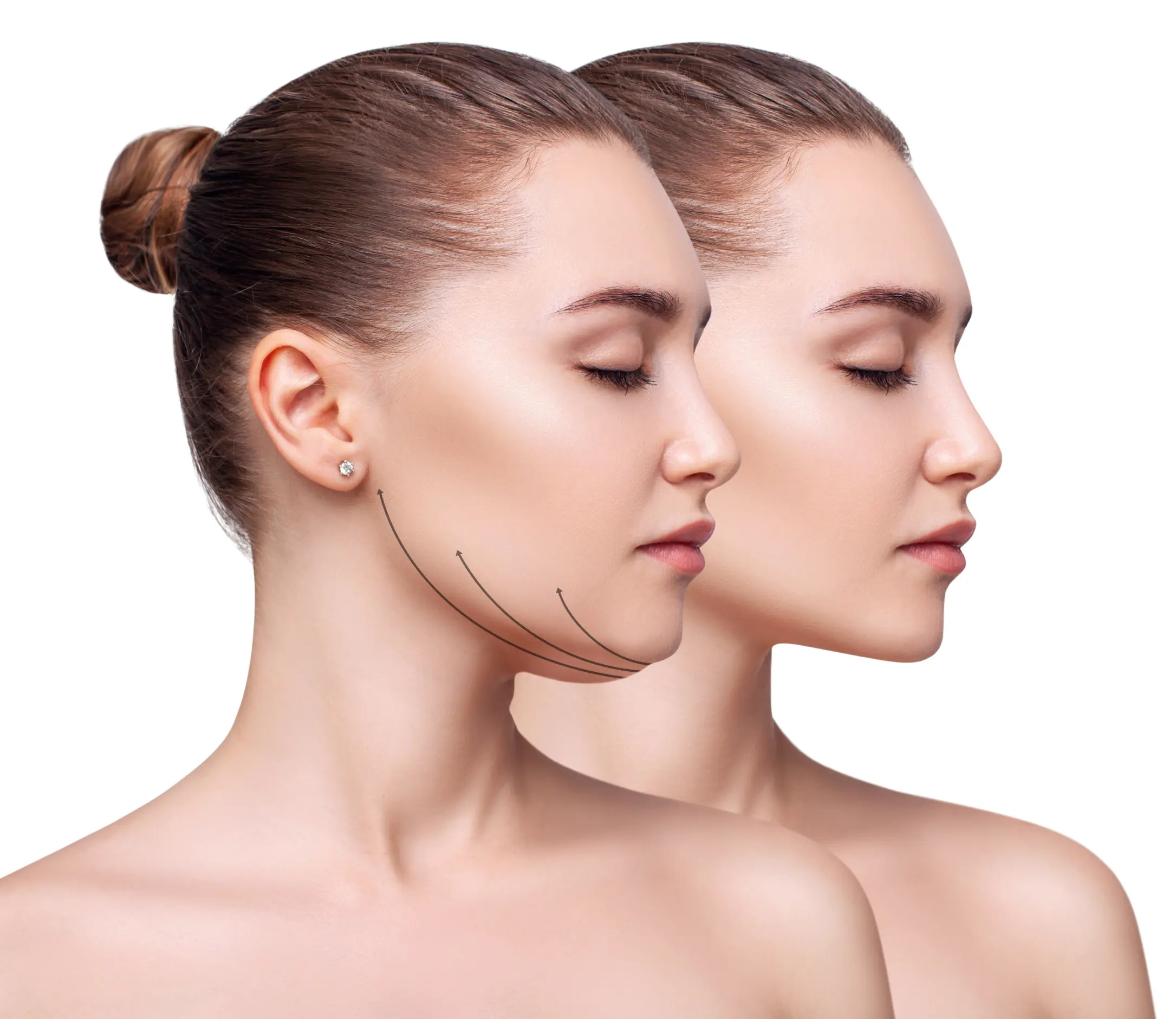two women