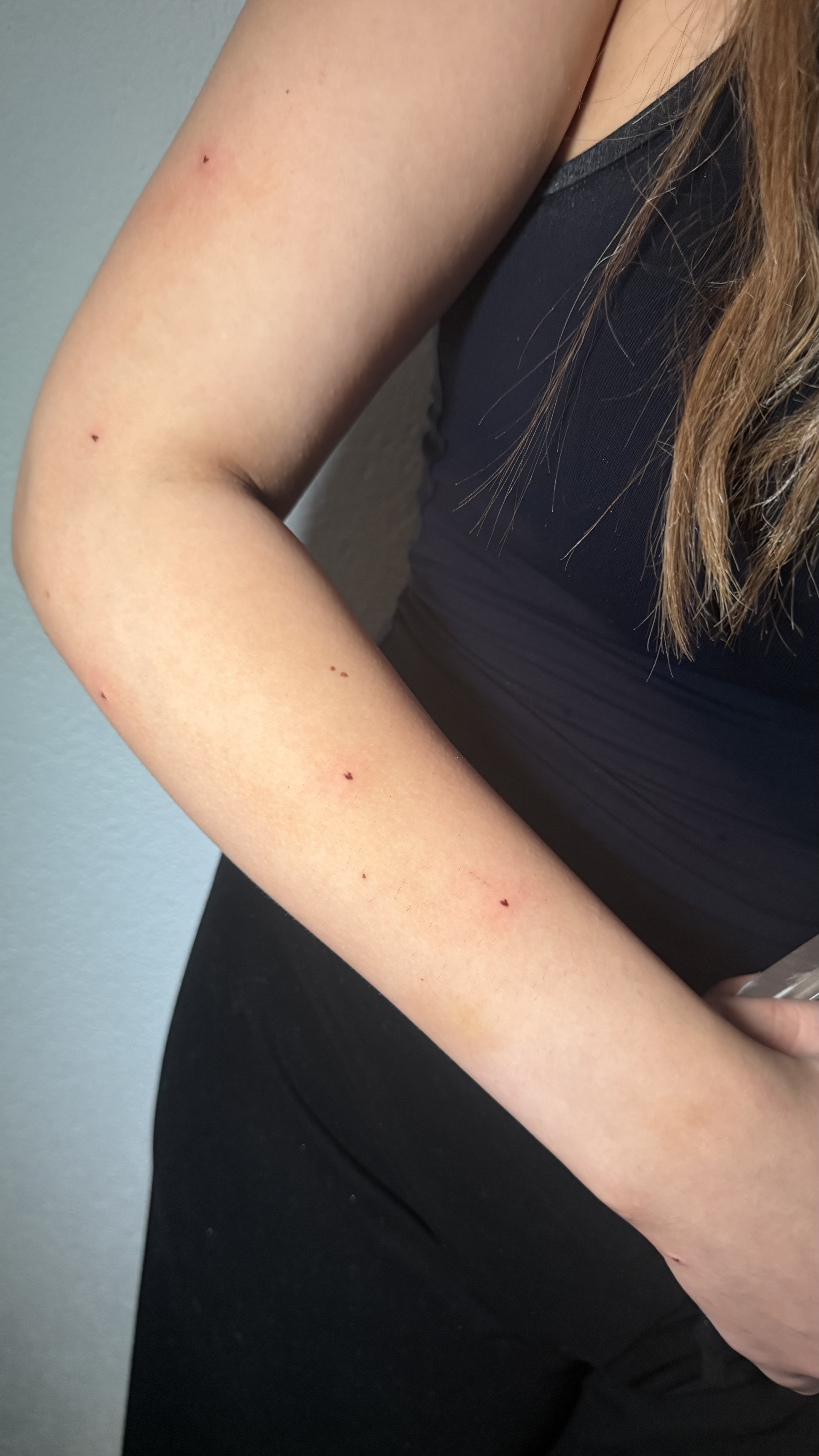 Heart Freckle Ergebnis bei Marino Cosmetics