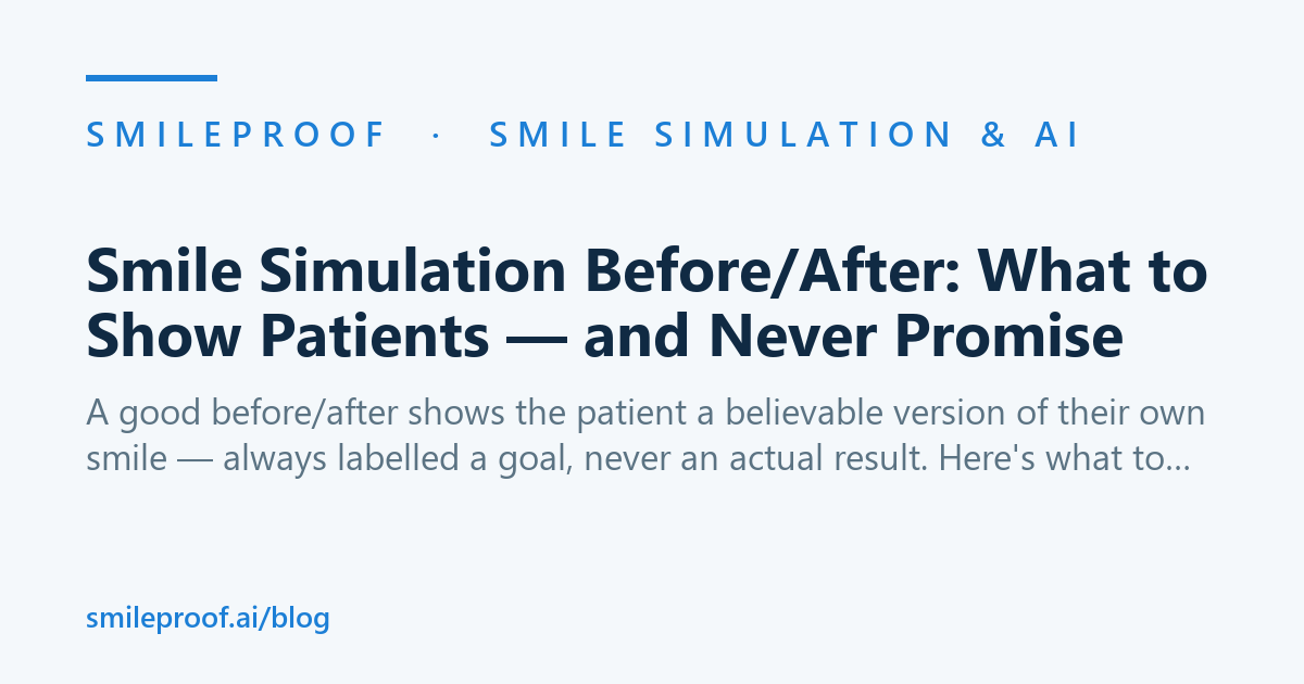 Smile Simulation Before/After: What to Show Patients — and Never Promise — Smileproof