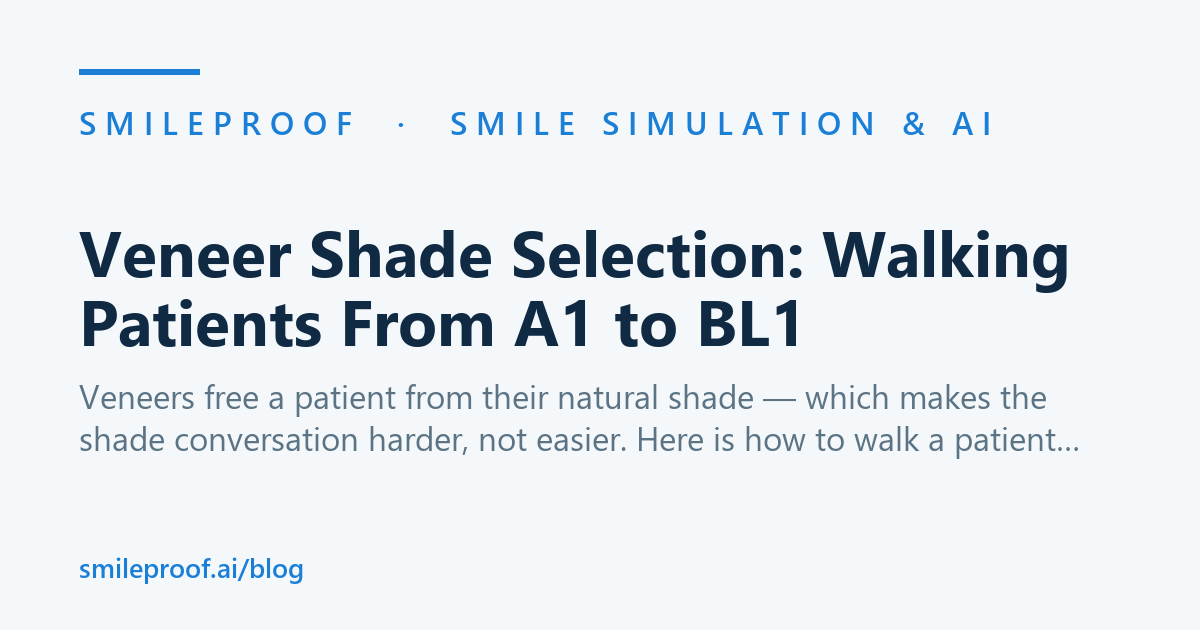 Veneer Shade Selection: Walking Patients From A1 to BL1
