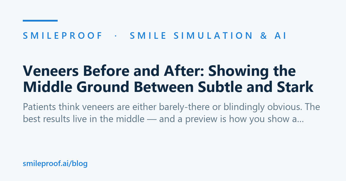 Veneers Before and After: Showing the Middle Ground Between Subtle and Stark | Smileproof