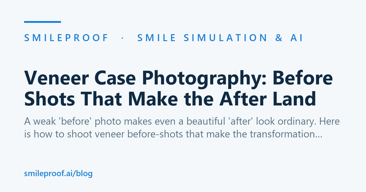 Veneer Case Photography: Before Shots That Make the After Land — Smileproof