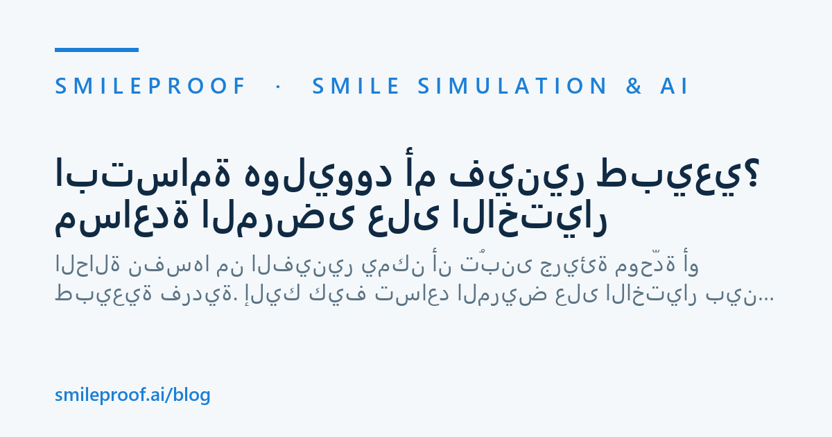 ابتسامة هوليوود أم فينير طبيعي؟ مساعدة المرضى على الاختيار — Smileproof