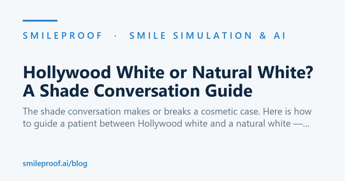 Hollywood White or Natural White? A Shade Conversation Guide