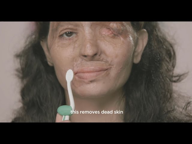 #ACID ATTACK Beauty Tips by Reshma: How to get perfect red lips