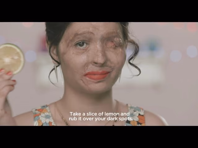 #ACID ATTACK Beauty Tips by Reshma: How to get rid of dark spots naturally - First December Films